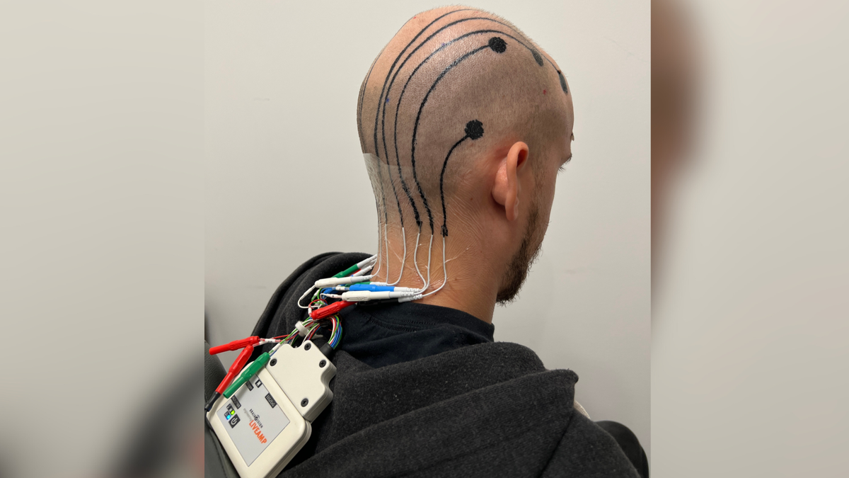 Les tatouages ​​« électroniques » du cuir chevelu pourraient être la prochaine grande nouveauté en matière de surveillance cérébrale