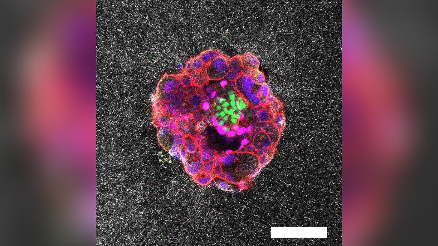 Un embryon rose, violet, rouge et vert sur un fond blanc et noir marbré