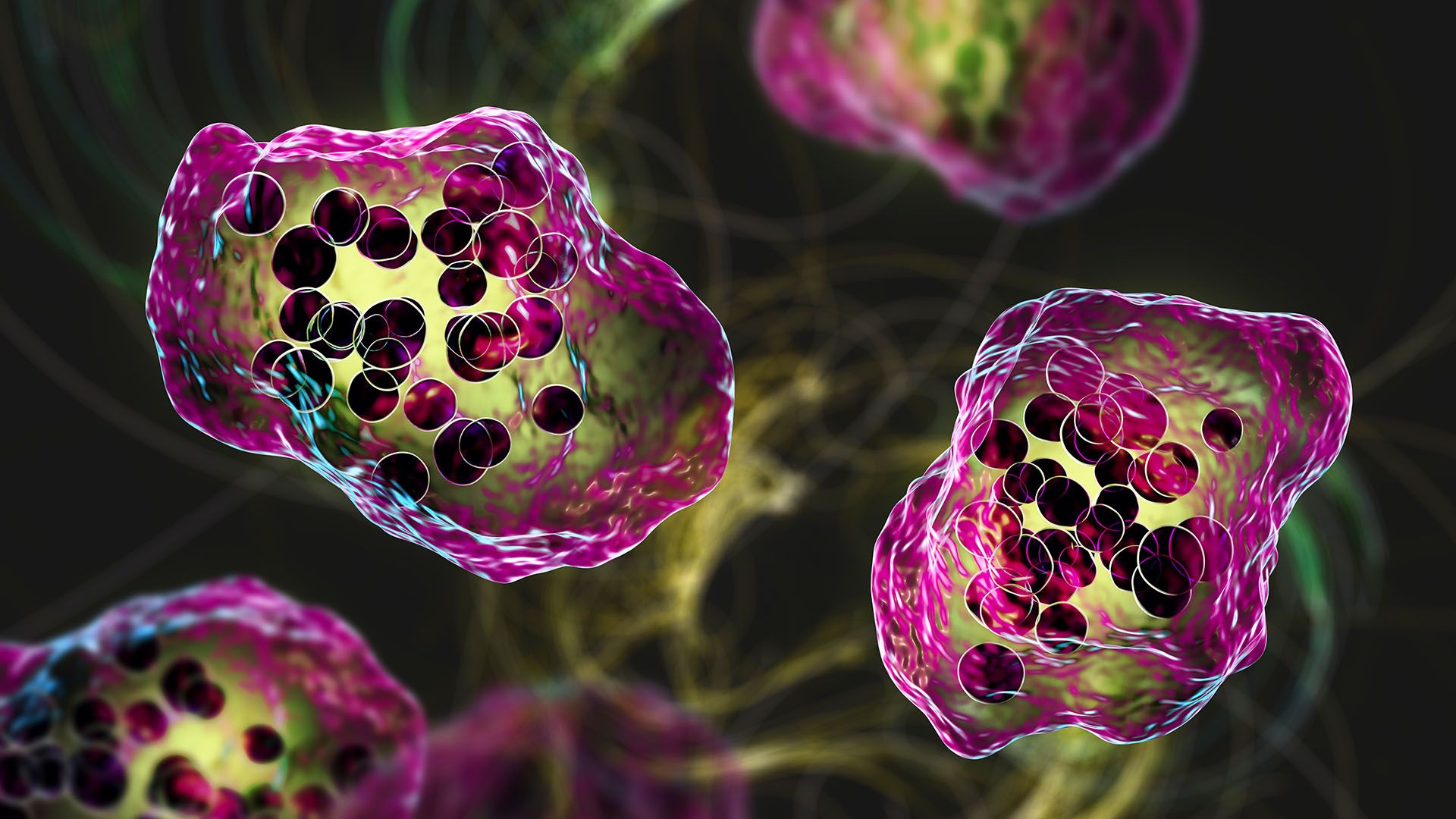 illustration of giant multinucleated cells seen during microscopy of biopsy specimens from people with measles infection