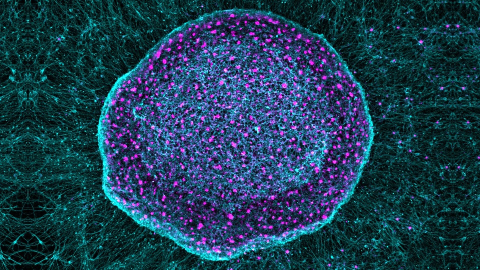 une image d'un neurone taché de violet avec des vrilles turquoise qui s'en étendent