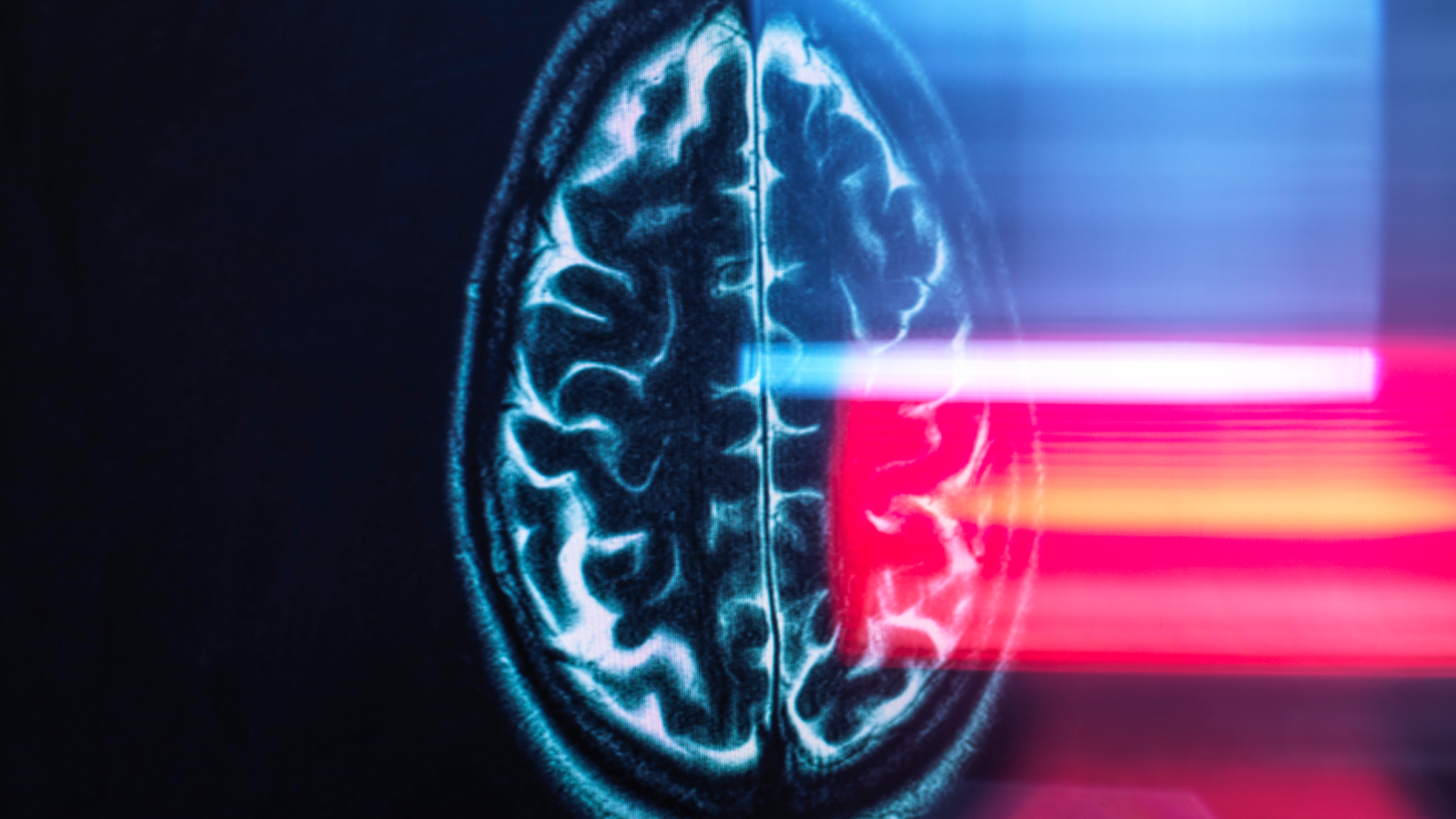 Réfection de l'IRM cérébrale sur l'écran du moniteur.