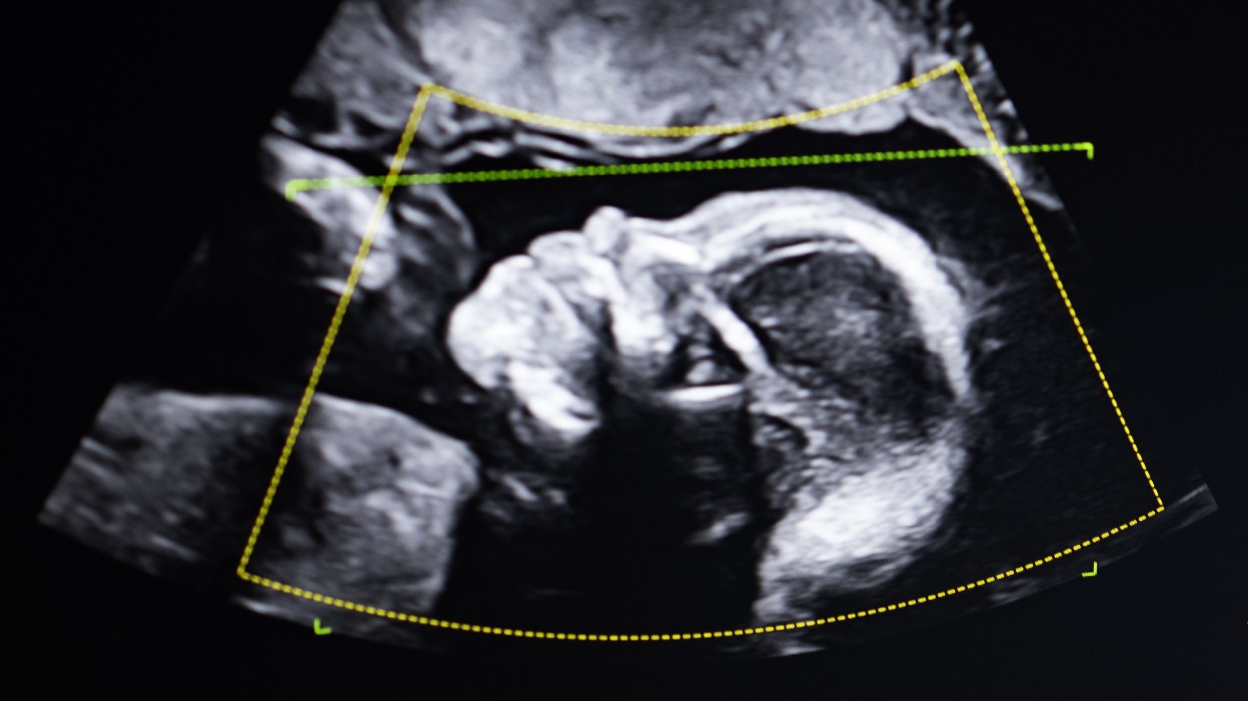 «Ça ne ment pas. Alors qui es-tu ?' : Que se passe-t-il lorsque des tests ADN montrent qu'une femme n'est pas la mère de l'enfant qu'elle a donné naissance ?