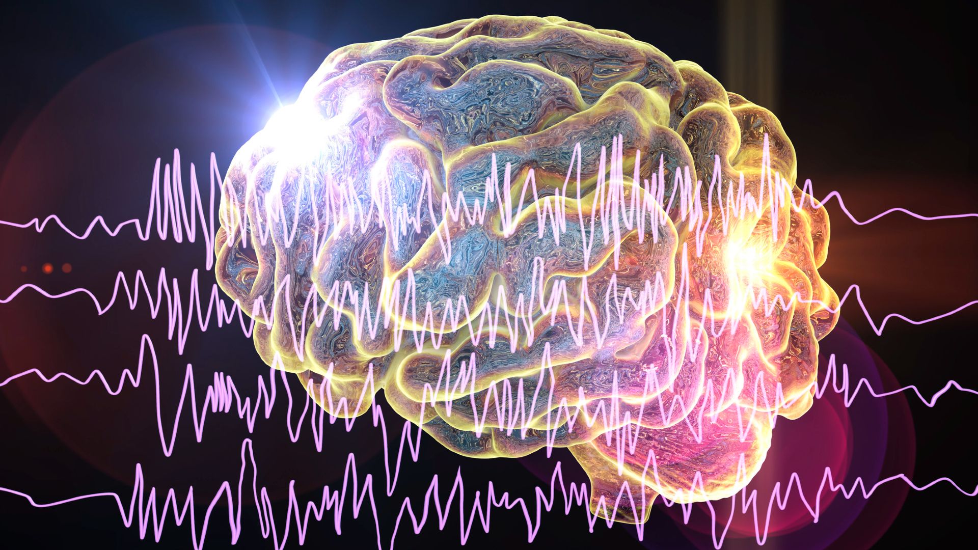 A cartoon image of a brain with waves across the front of it.