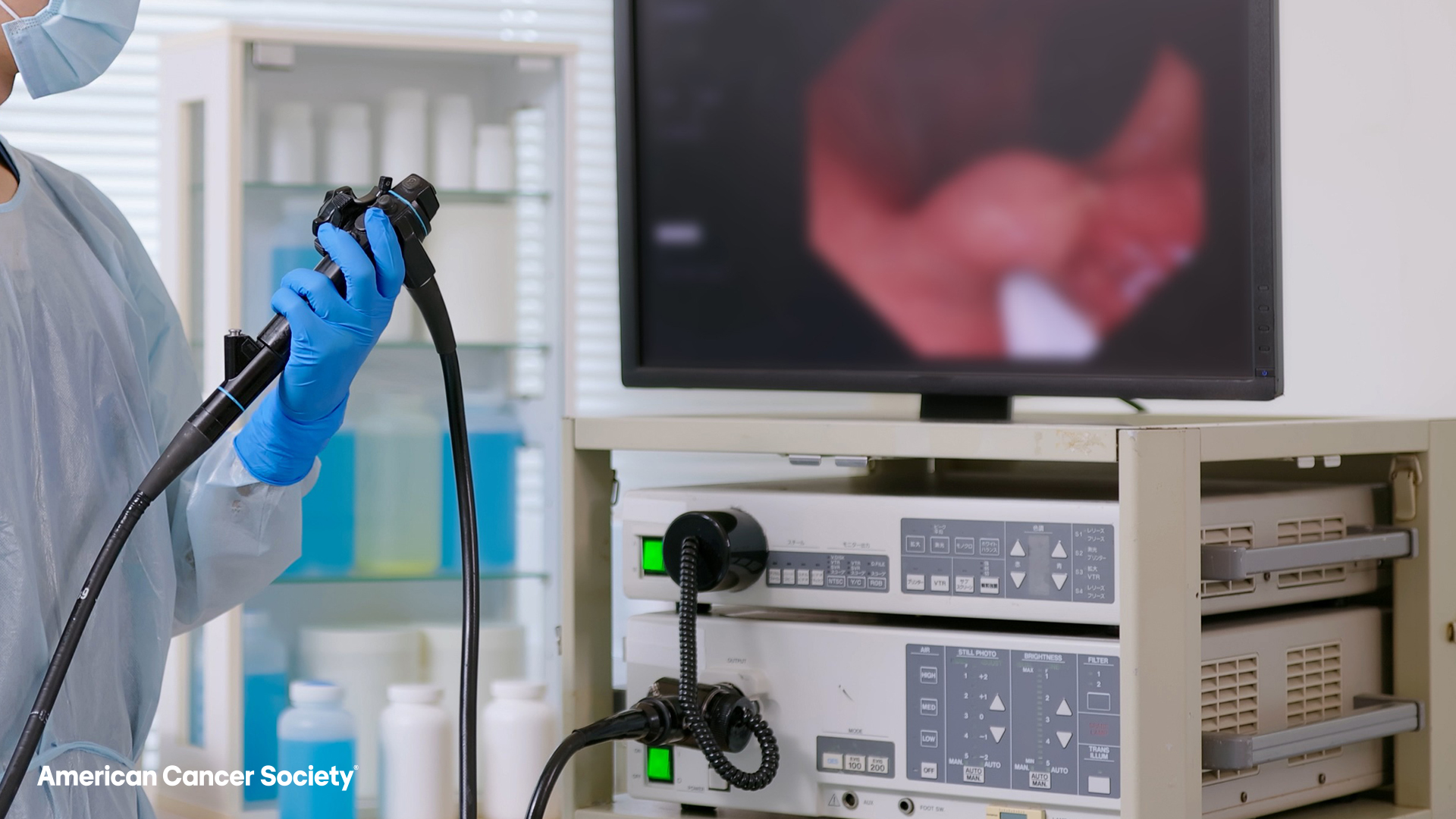 Professionnel de la santé effectuant une coloscopie