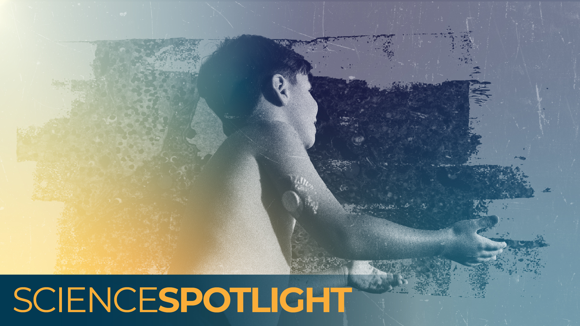 un photocollage d'un jeune garçon avec un glucomètre jouant, avec un fond de microscopie cellulaire