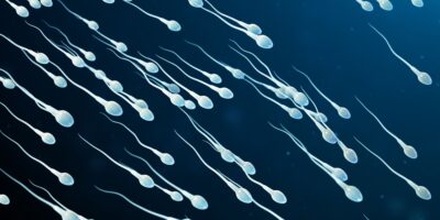 Dilemme diagnostique : l&rsquo;infertilité de la femme pourrait avoir été causée par une allergie rare au sperme
