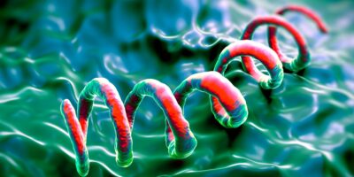 Dilemme diagnostique : Un homme de 83 ans s&rsquo;est rendu à l&rsquo;hôpital en raison de démangeaisons cutanées très prononcées. Il s’est avéré qu’il souffrait d’une forme rare de syphilis.