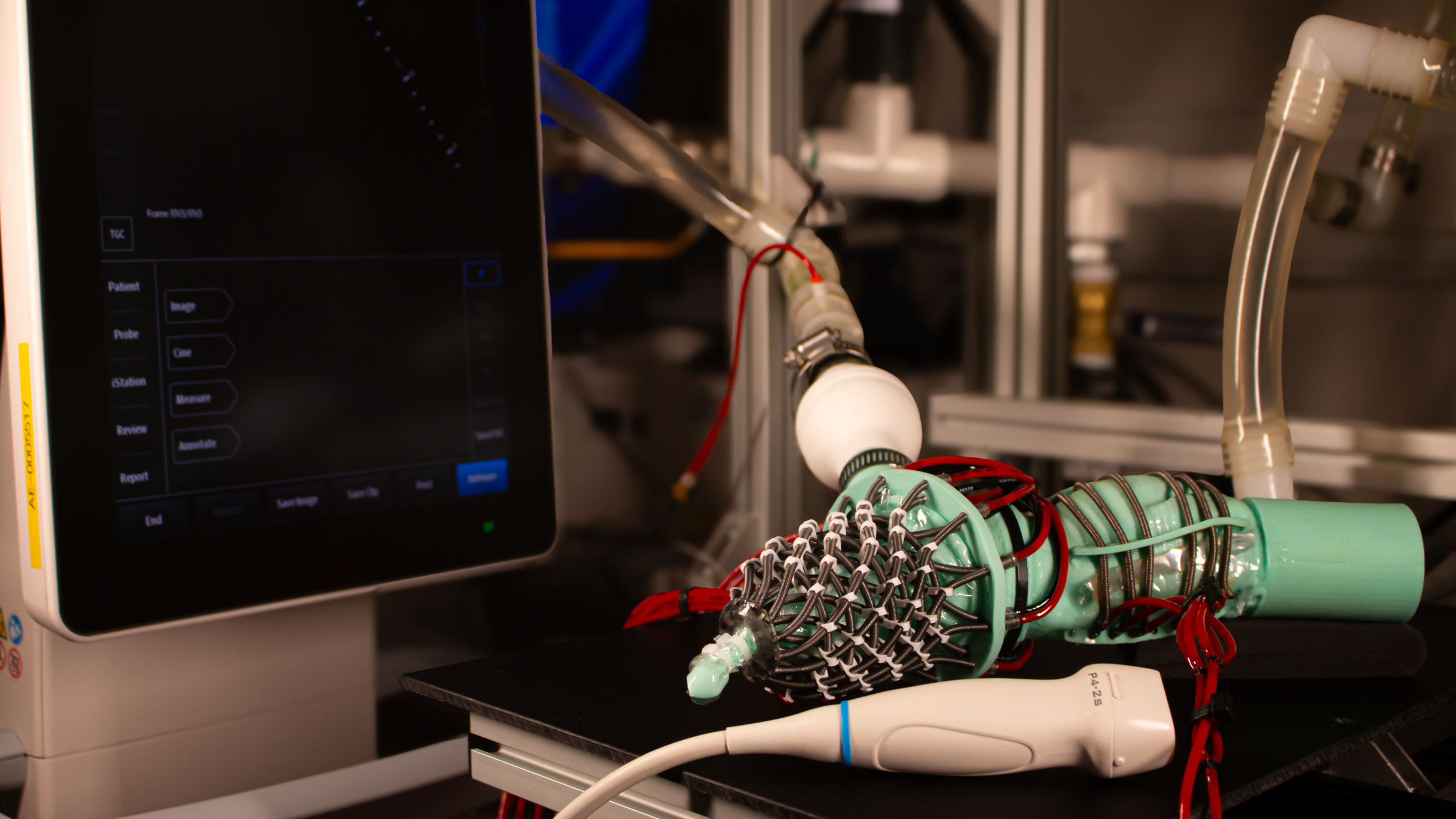 Un nouveau cœur robotique imite une maladie courante et mystérieuse pour aider les chercheurs à l'étudier