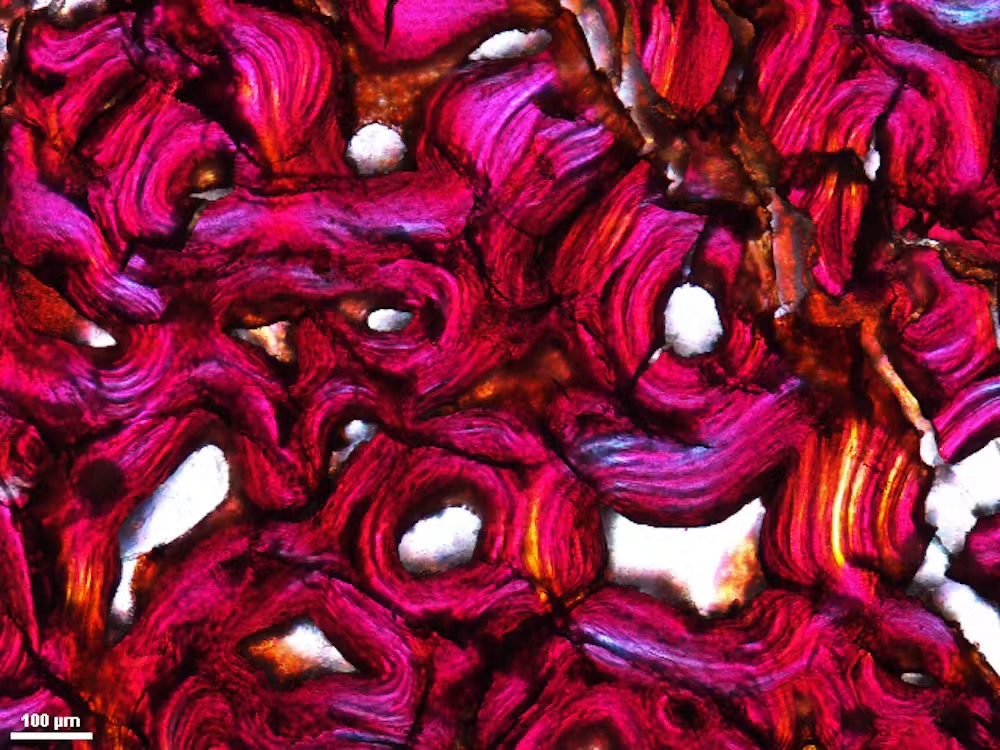 Un gros plan de globules rouges au microscope