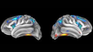 Les découvertes des neurosciences ne peuvent souvent pas être reproduites – et c'est un gros problème pour ce que nous savons sur le cerveau
