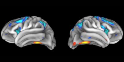 Les découvertes des neurosciences ne peuvent souvent pas être reproduites – et c&rsquo;est un gros problème pour ce que nous savons sur le cerveau