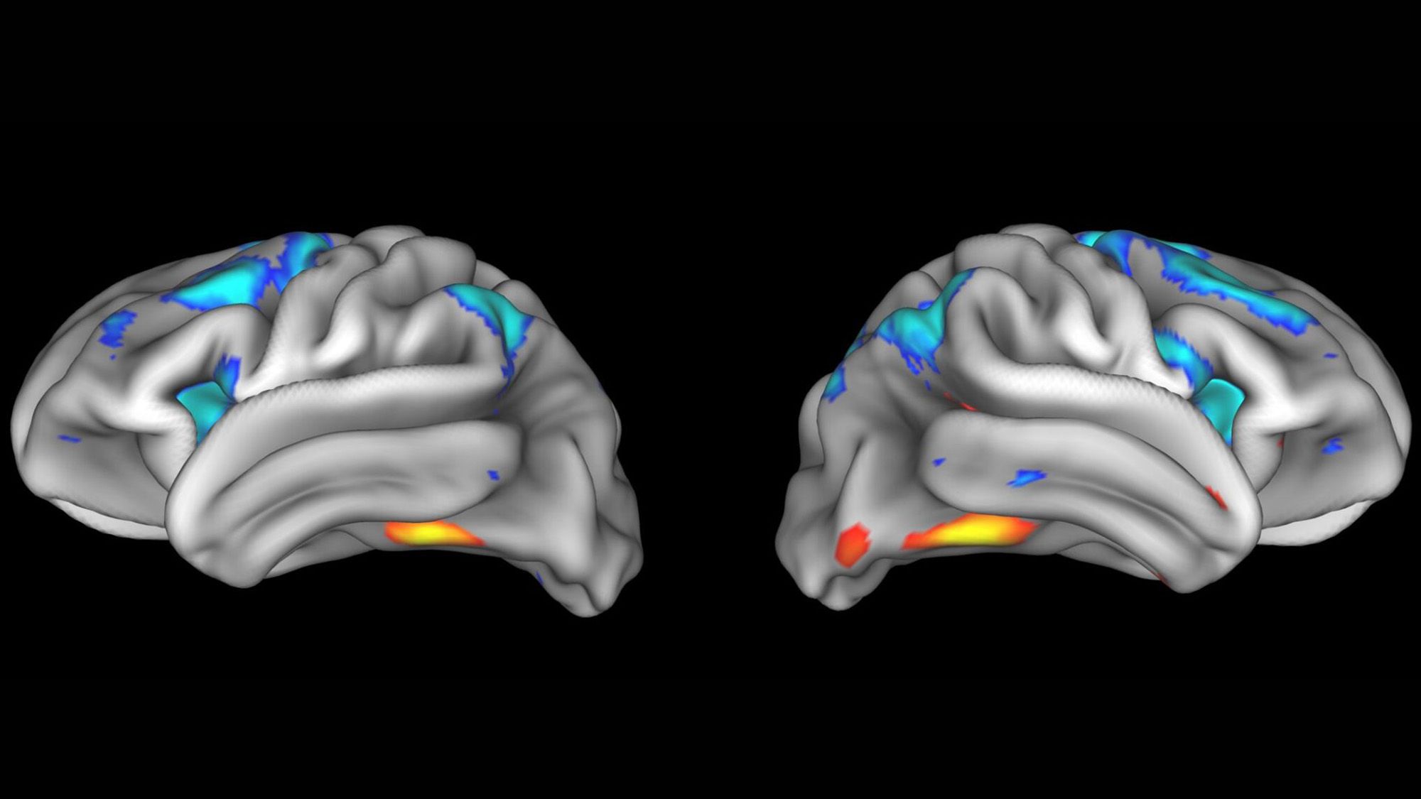 Les découvertes des neurosciences ne peuvent souvent pas être reproduites – et c'est un gros problème pour ce que nous savons sur le cerveau
