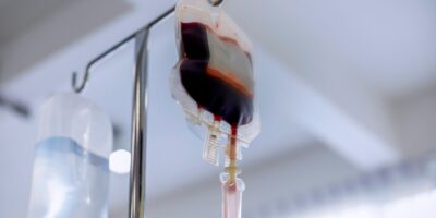 Dilemme diagnostique : un enfant de 6 ans développe une réaction allergique potentiellement mortelle après une transfusion sanguine