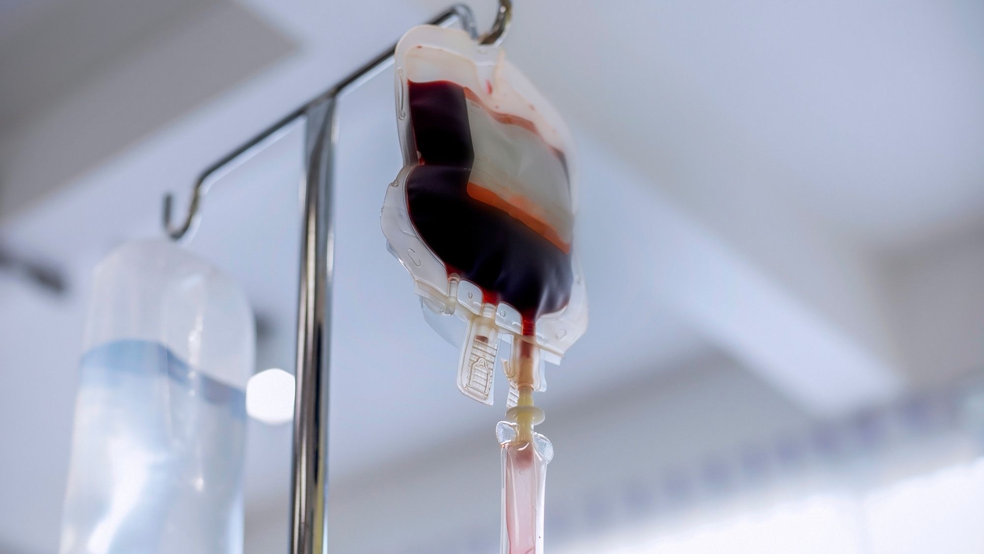 Dilemme diagnostique : un enfant de 6 ans développe une réaction allergique potentiellement mortelle après une transfusion sanguine