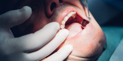 Les bactéries à l’origine des maladies des gencives peuvent également endommager vos valvules cardiaques, suggèrent les premières recherches