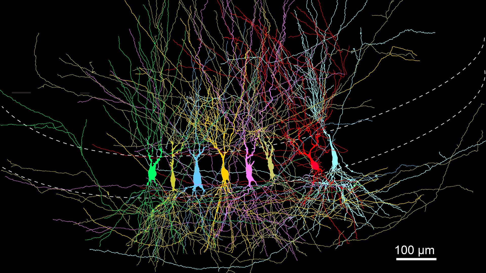 A microscopic image of a series of different colored tendrils within a curve, with a micrometer bar next to the grouping.