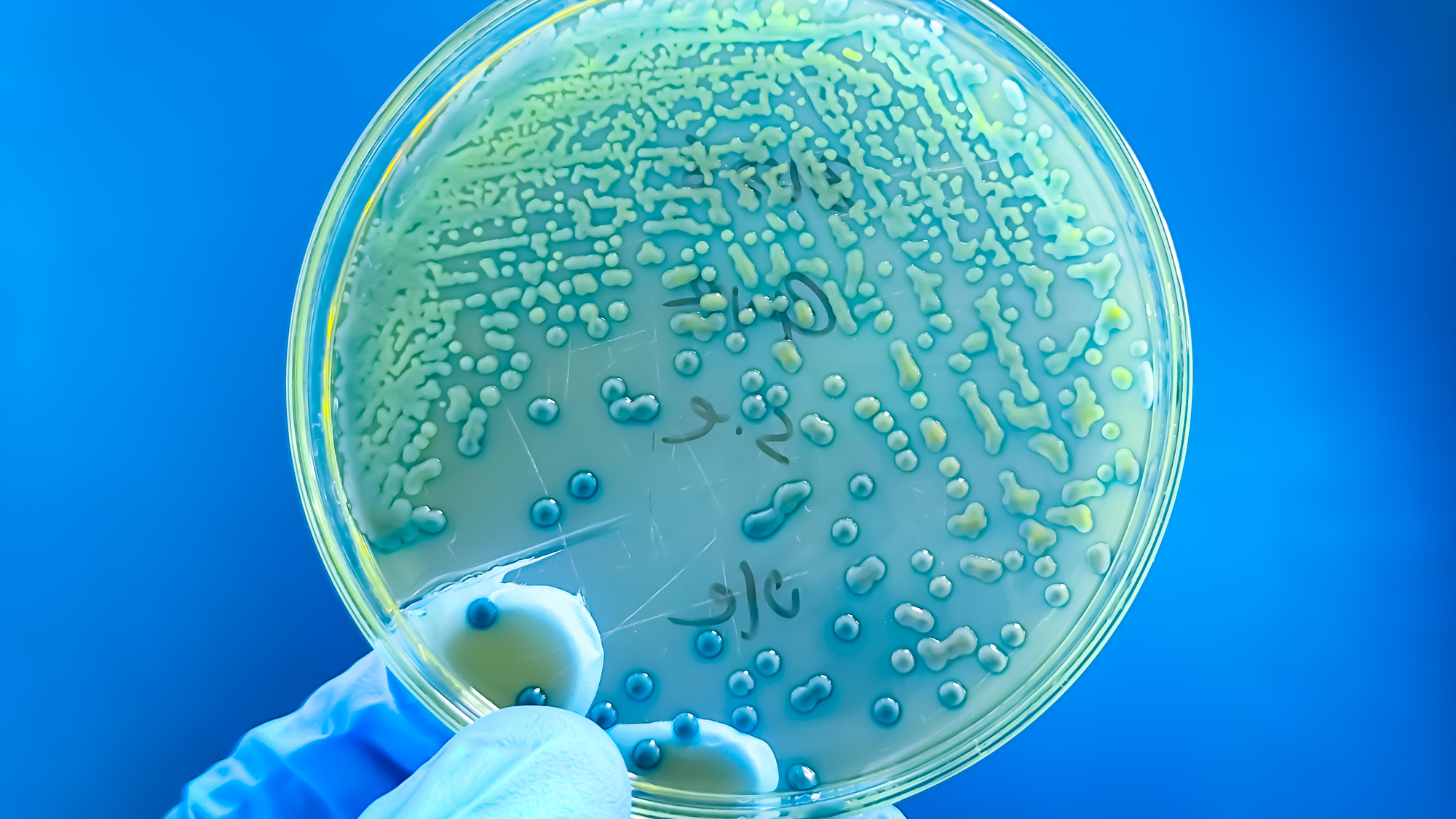 « C'est réel et cela se produit » : la résistance aux antibiotiques chez les enfants augmente partout dans le monde, selon une étude massive