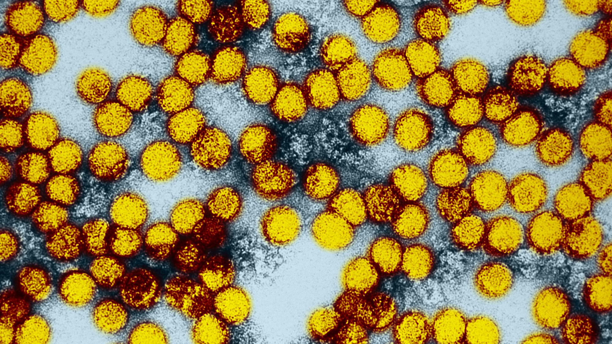 Une série de particules virales sphériques jaunes sur fond blanc