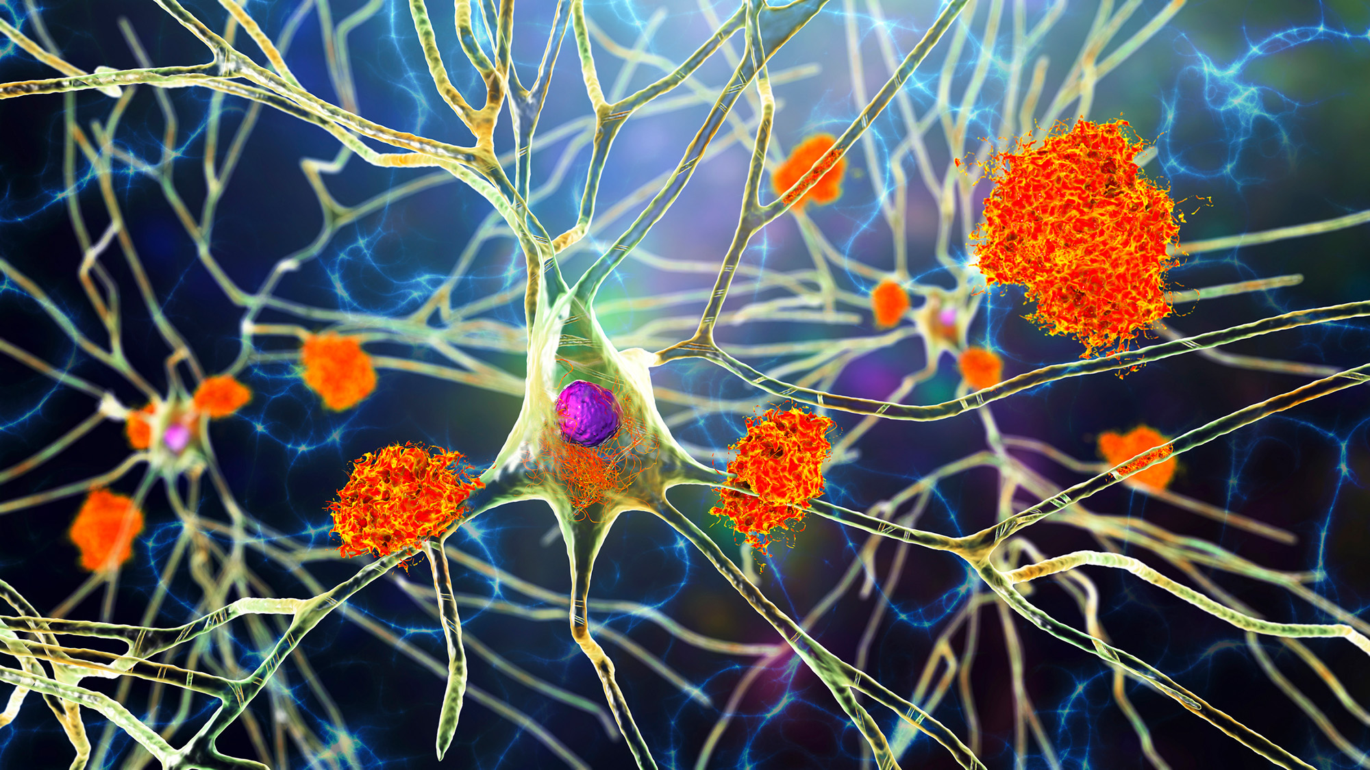Une illustration de neurones filandreux avec des cellules orange dessus.