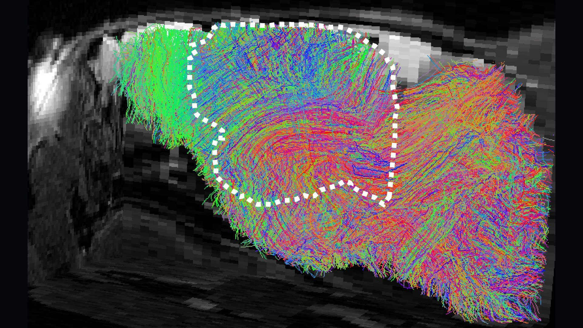 Vue latérale du cerveau d'une souris avec des fibres nerveuses étiquetées en couleurs vives