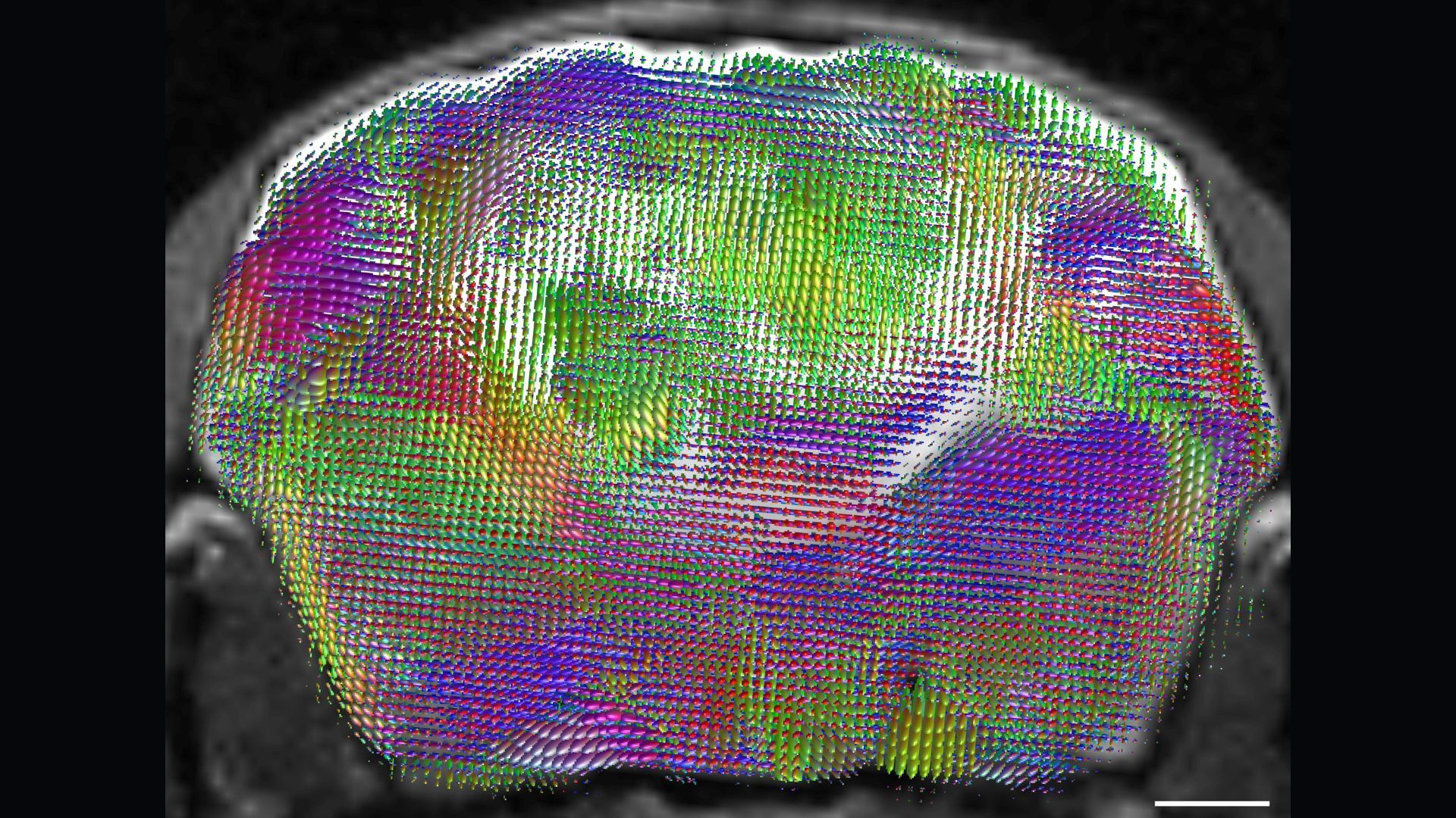 Une autre vue du cerveau d'une souris avec des fibres nerveuses étiquetées en couleurs vives