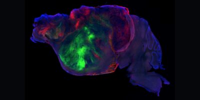 Les scientifiques ont rétréci le cerveau de souris et remplacé les tissus manquants par des « organoïdes » humains