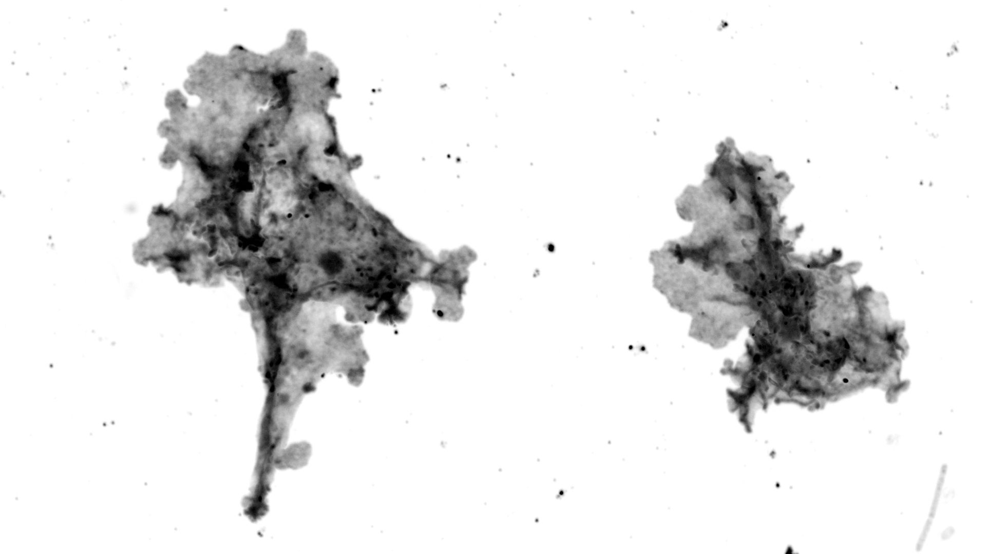 Une image en noir et blanc de deux amibes différentes sur un fond clair