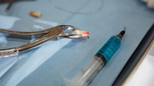 Dilemme diagnostique : d'étranges pointes perçant la paupière d'un adolescent se sont révélées être une dent capricieuse
