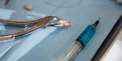 Dilemme diagnostique : d&rsquo;étranges pointes perçant la paupière d&rsquo;un adolescent se sont révélées être une dent capricieuse