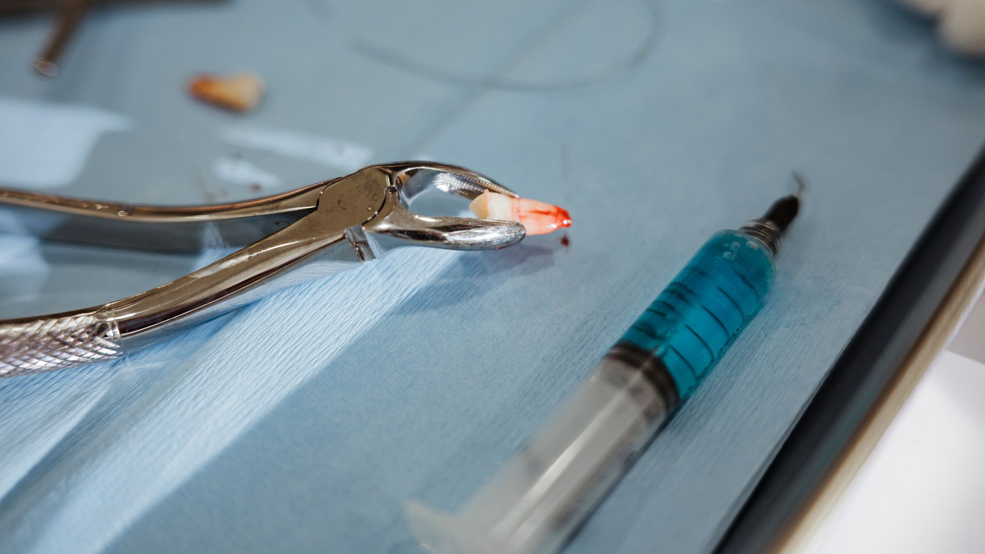 Dilemme diagnostique : d'étranges pointes perçant la paupière d'un adolescent se sont révélées être une dent capricieuse