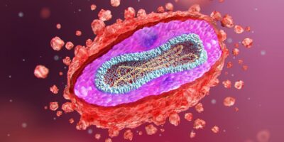 La Mpox se propage toujours aux États-Unis — voici ce qu&rsquo;il faut savoir sur les vaccins, les symptômes et le traitement
