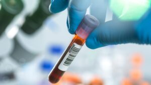 Les scientifiques ont identifié une « signature protéique » dans le sang qui pourrait prédire un vieillissement en bonne santé