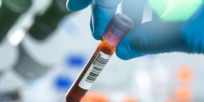 Les scientifiques ont identifié une « signature protéique » dans le sang qui pourrait prédire un vieillissement en bonne santé