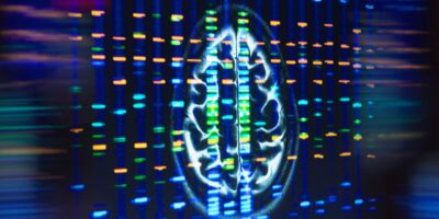 Une variante génétique triple le risque de contracter la maladie d&rsquo;Alzheimer – l&rsquo;accumulation de graisse dans les cellules cérébrales pourrait en être la cause, selon une étude